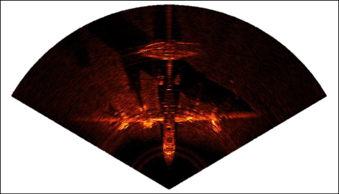 Figure 12 - Multibeam Sonar: Example